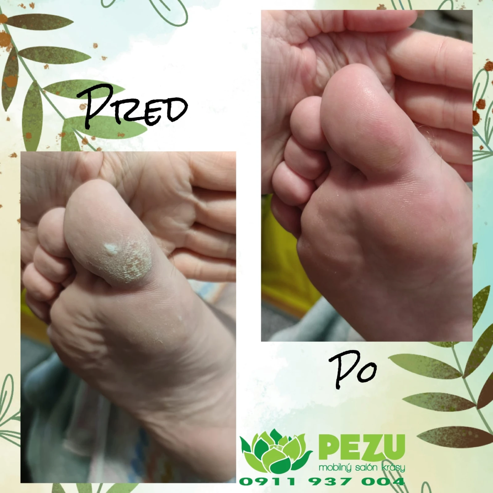 Zdravé nohy po mokrej pedikúre